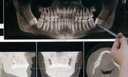 Radiodiagnostyka stomatologiczna